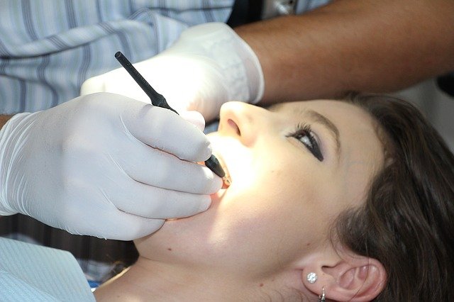 Saiba quais são os mitos e verdades sobre a limpeza dentária feita no consultório