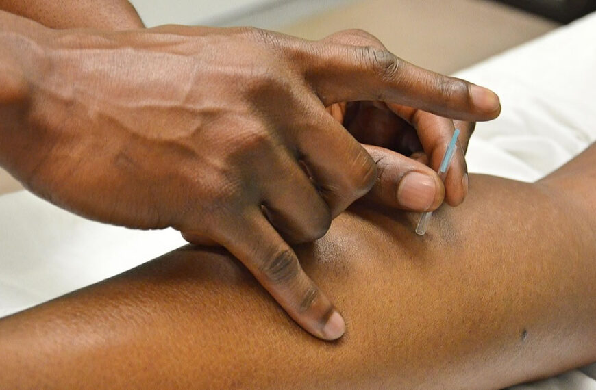 Entenda por que a acupuntura é recomendada por médicos para tratar dor